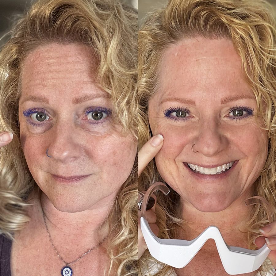 Before and after