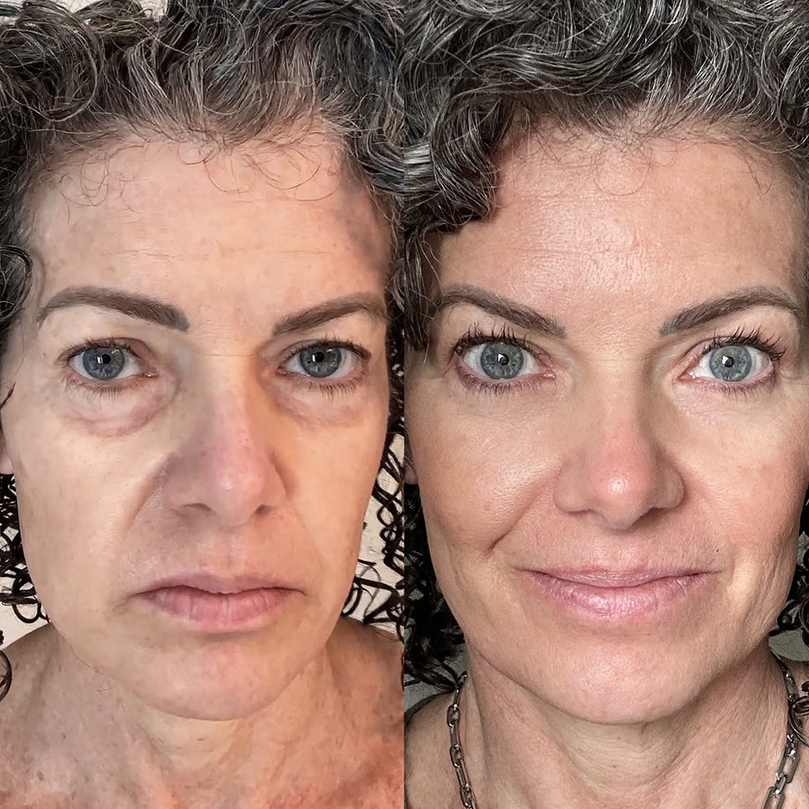 Customer result example two