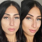 Multi - Spectral Chin & Neck Tightening Light Therapy® Device - Botanique Paris