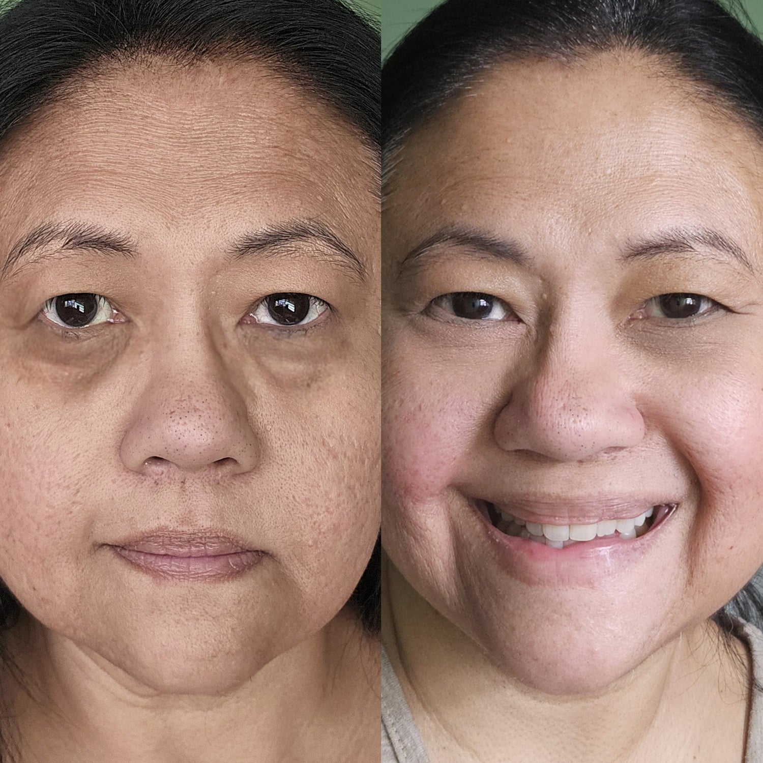Before and After