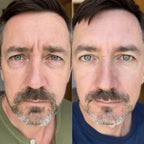 RevitalEyes® 2 - in - 1 Red Light Therapy + EMS To Erase Eye Bags - Botanique Paris