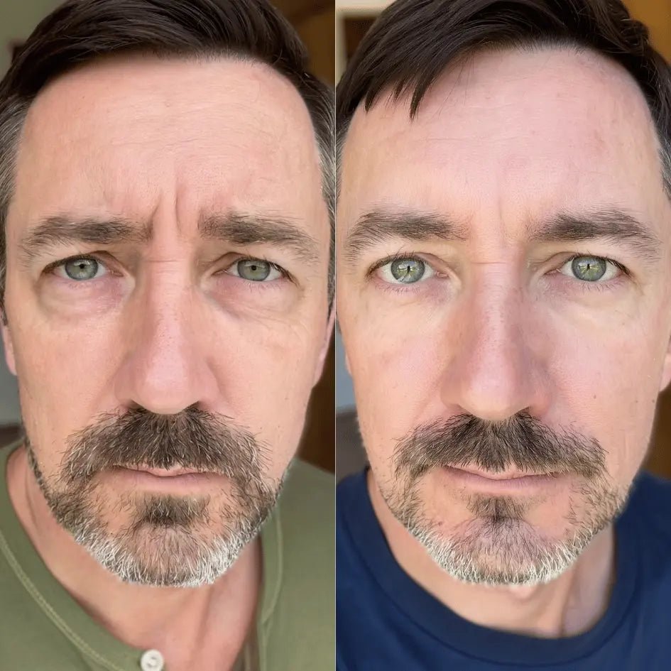 RevitalEyes® 2 - in - 1 Red Light Therapy + EMS To Erase Eye Bags - Botanique Paris