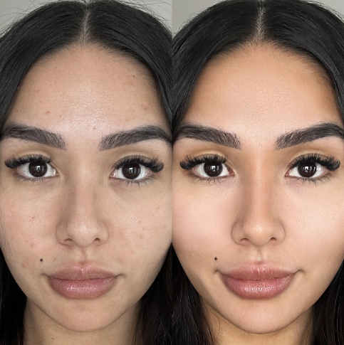 Before-and-after results from Botanique Paris LED face mask