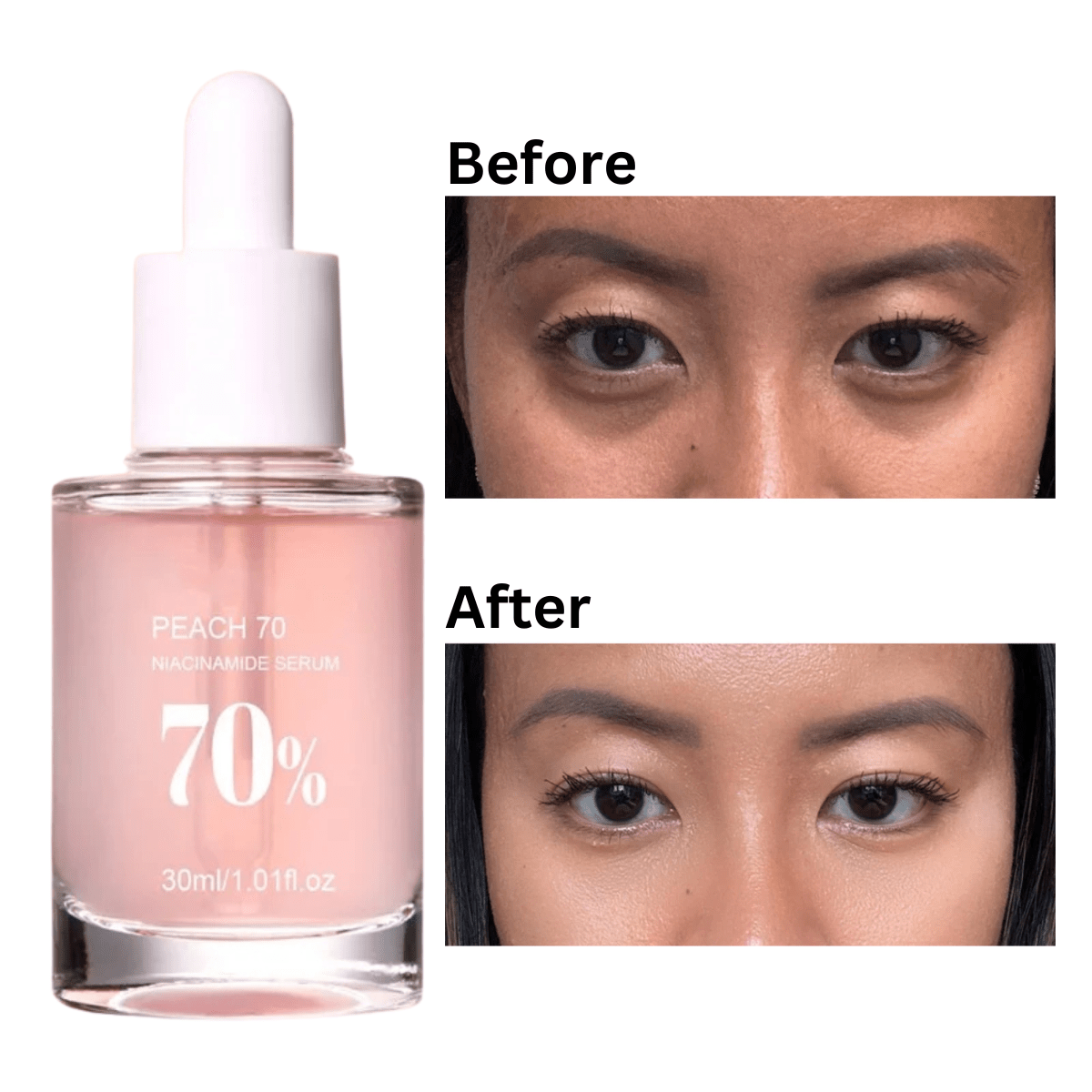 Peach Niacinamide Activating Serum - Botanique Paris