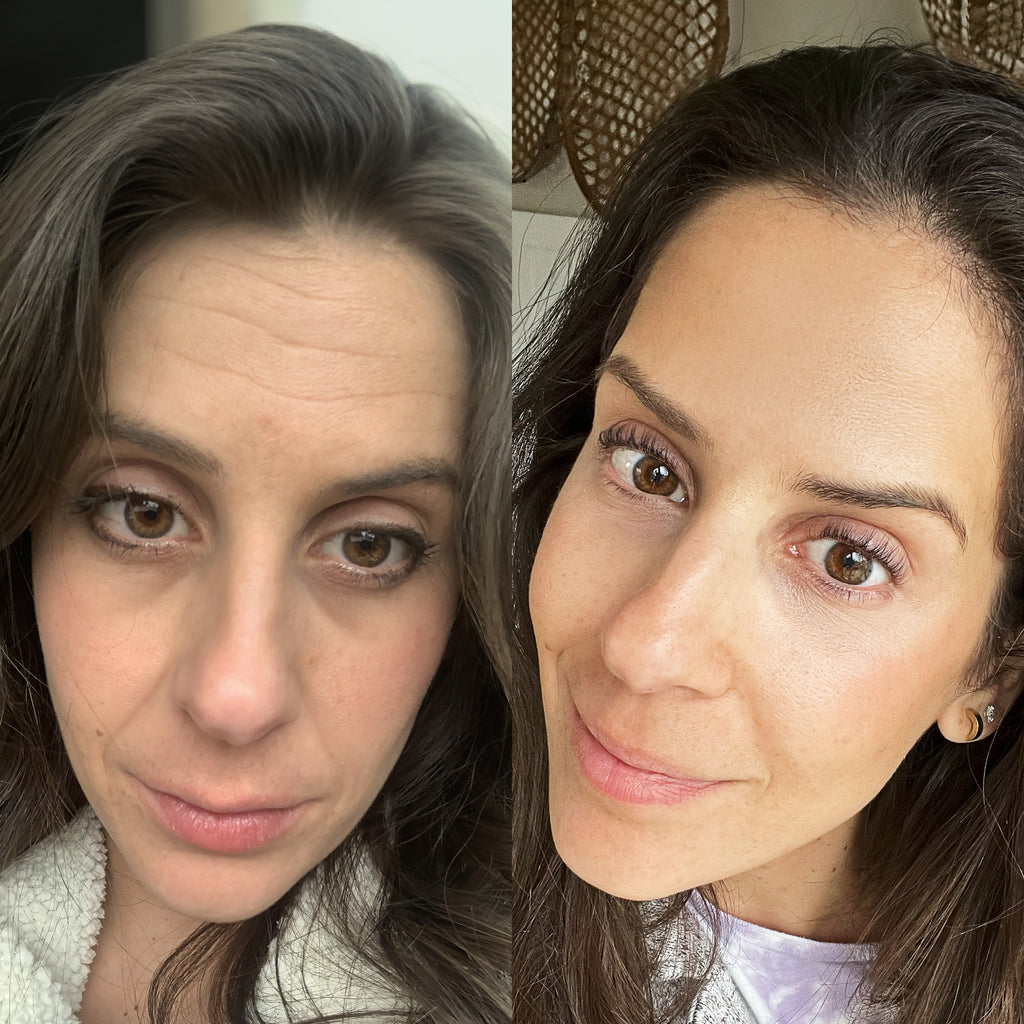 NovaGlow™ Red Light Therapy Wand - Botanique Paris