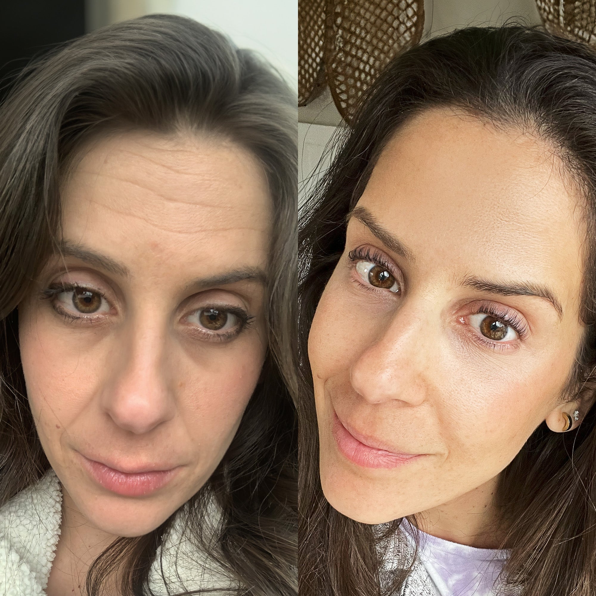 Multi - Spectral Chin & Neck Tightening Light Therapy® Device - Botanique Paris