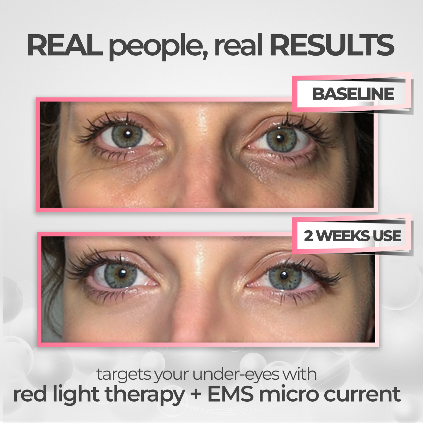 RevitalEyes