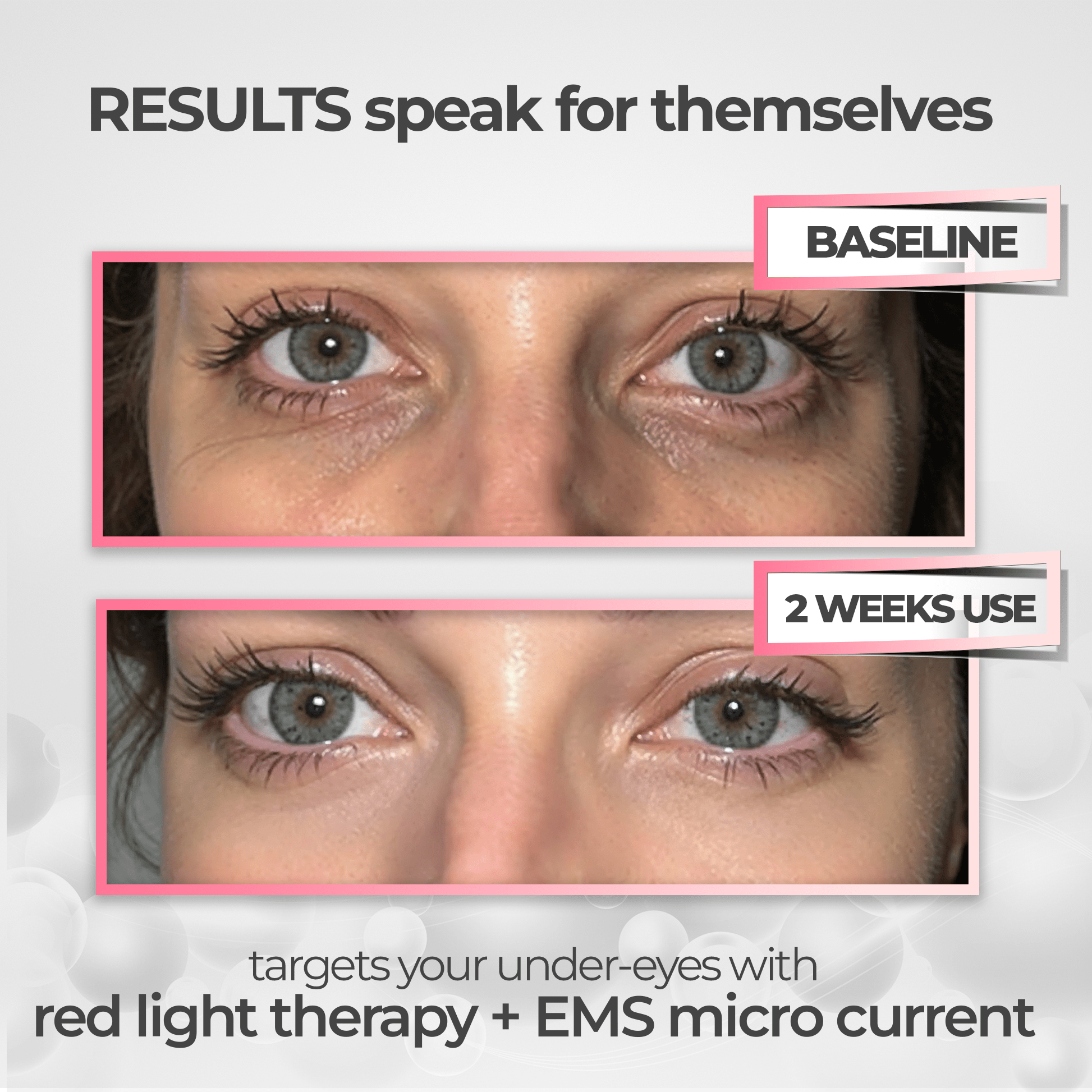 RevitalEyes® Under - Eye Red Light Therapy for Men - Botanique Paris