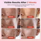 RevitaLight™ Therapy Face Mask - Botanique Paris