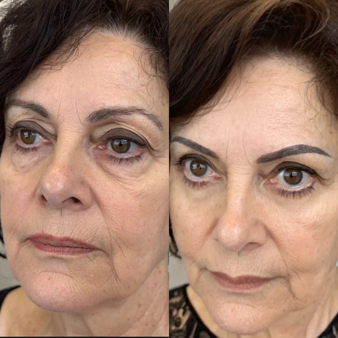 Before and after 3