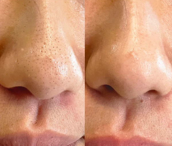 Finally, Something That Works