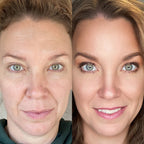 Multi - Spectral Chin & Neck Tightening Light Therapy® Device - Botanique Paris