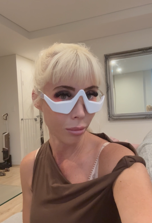 RevitalEyes Red Light Therapy Testimonials