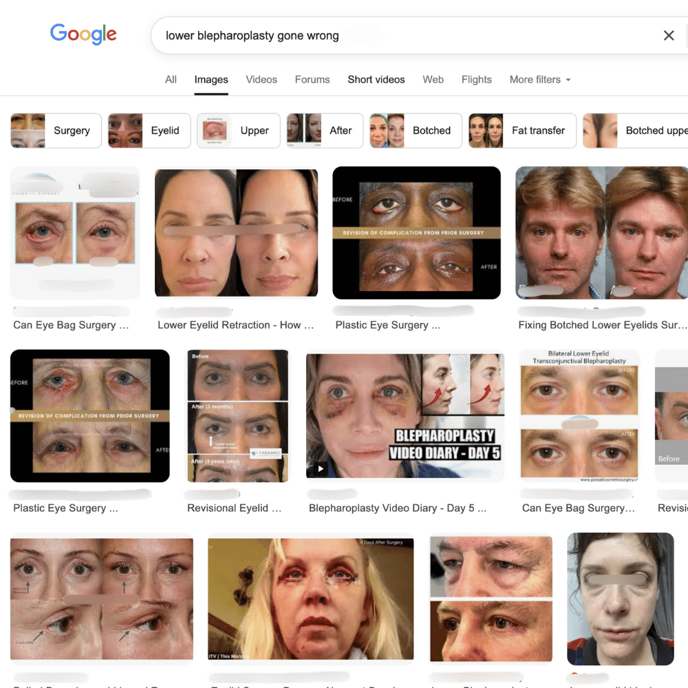 google-img