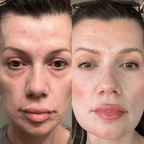 RevitalEyes® Under - Eye Red Light Therapy for Men - Botanique Paris