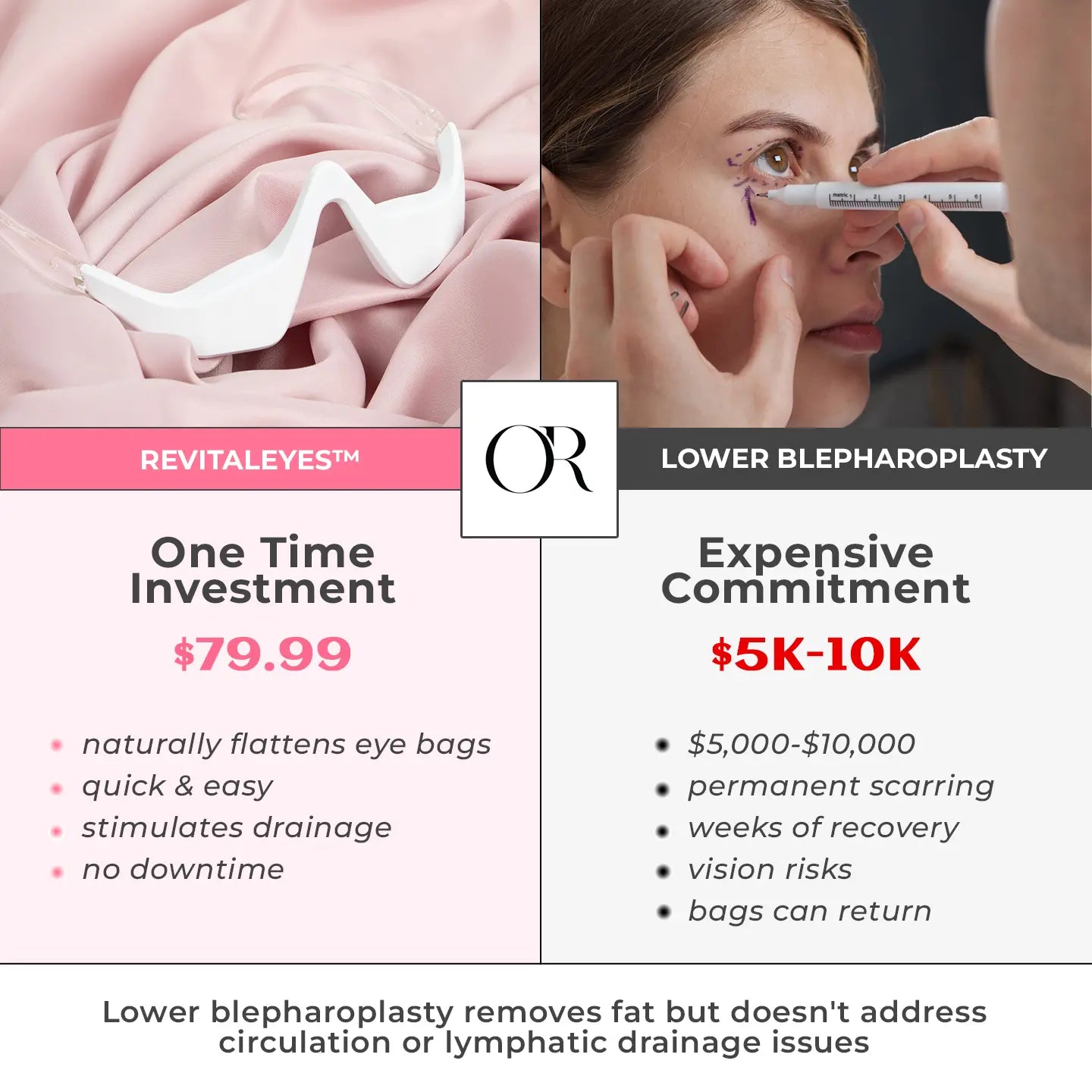 RevitalEyes® 2 - in - 1 Red Light Therapy + EMS To Erase Eye Bags - Botanique Paris