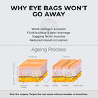 RevitalEyes® 2 - in - 1 Red Light Therapy + EMS To Erase Eye Bags - Botanique Paris