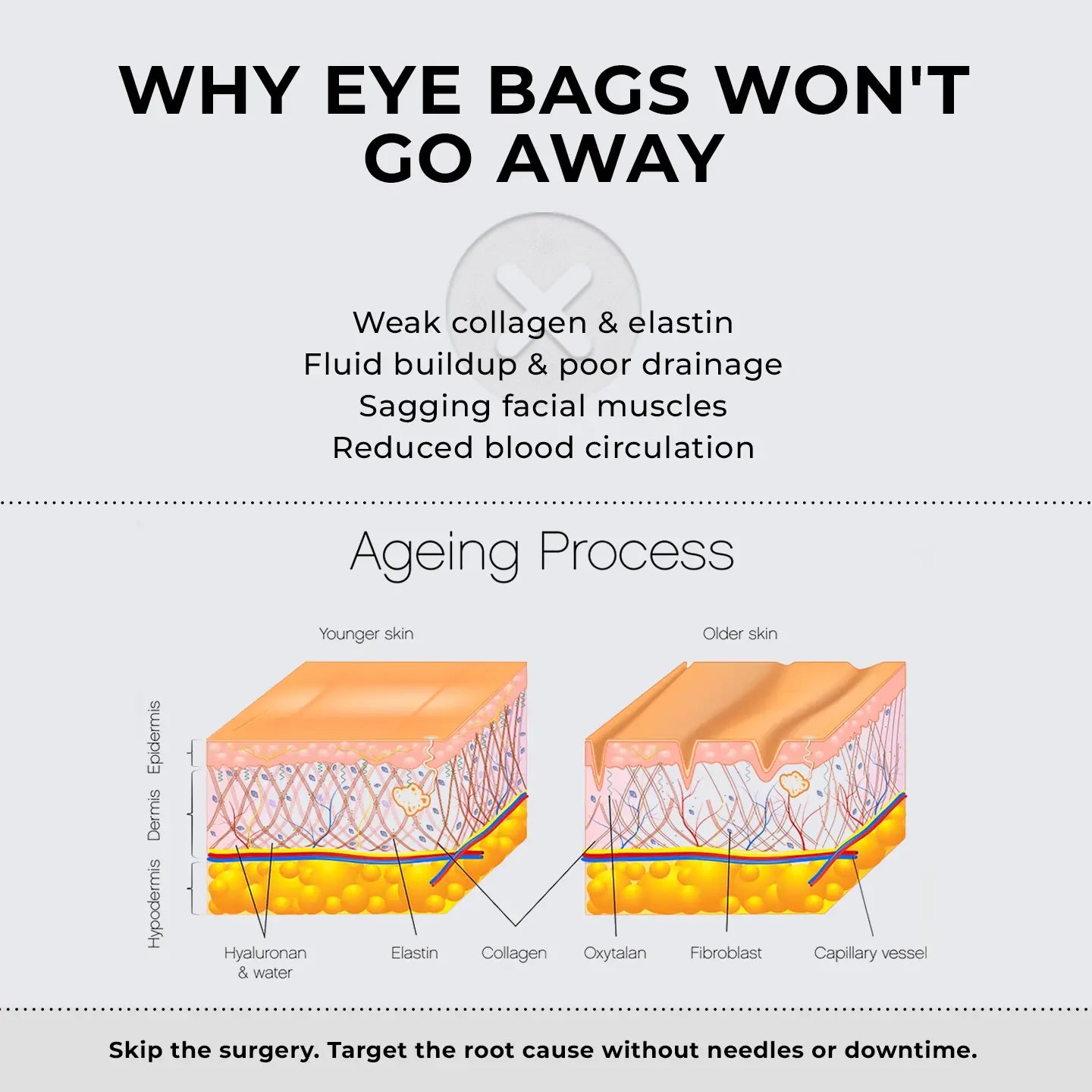 RevitalEyes® 2 - in - 1 Red Light Therapy + EMS To Erase Eye Bags - Botanique Paris