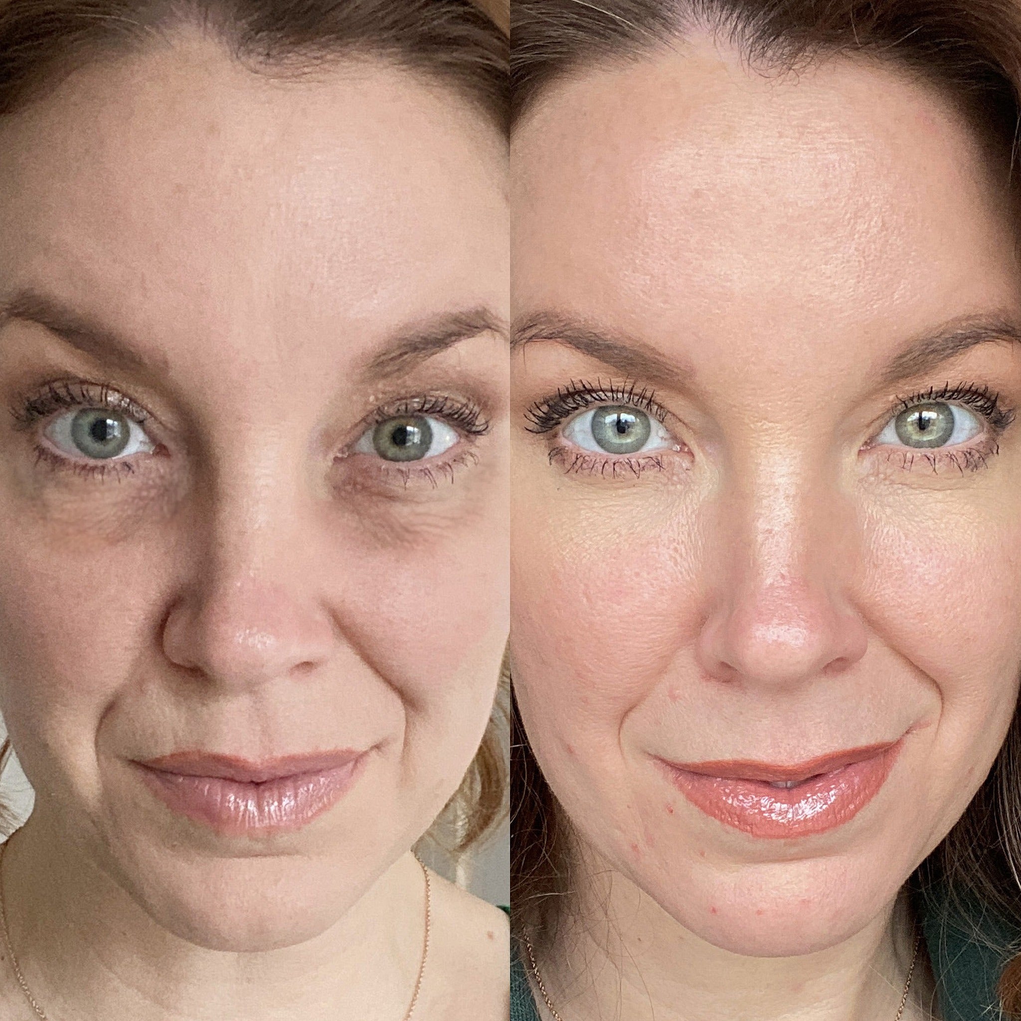 Ultimate Red Light Therapy Bundle - Botanique Paris