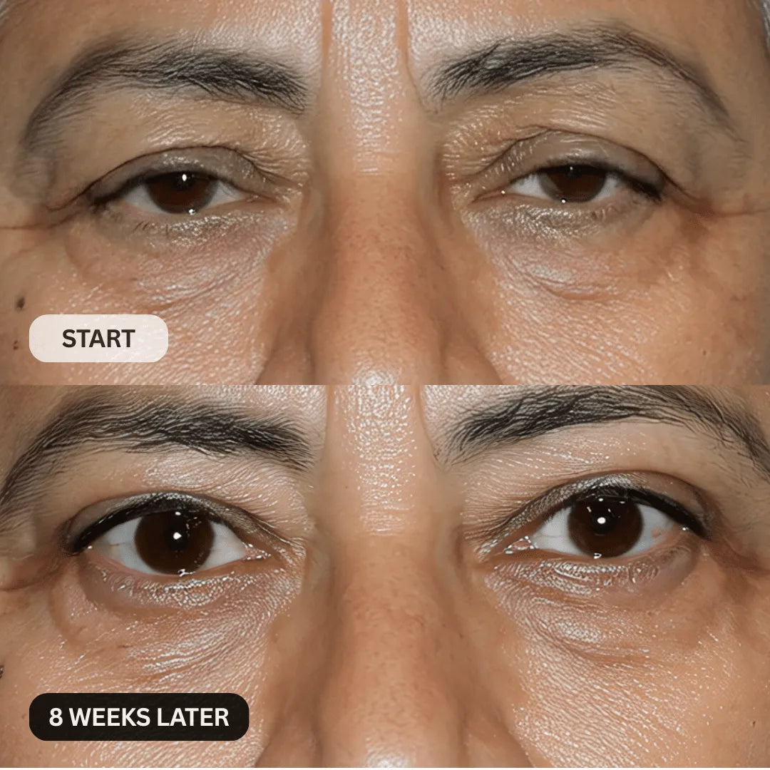 Close-up before and after