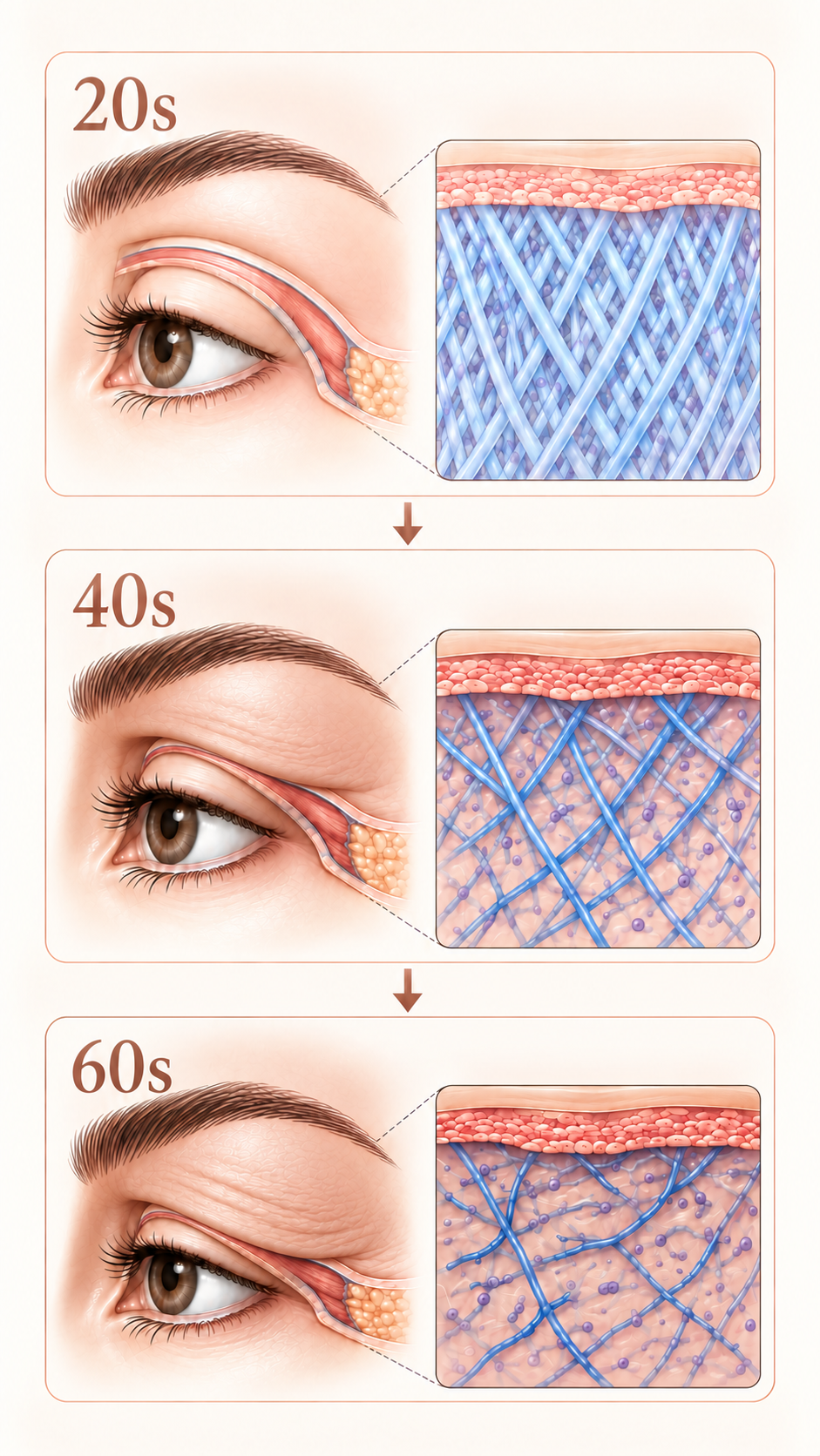 Collagen decline in the upper eyelid area