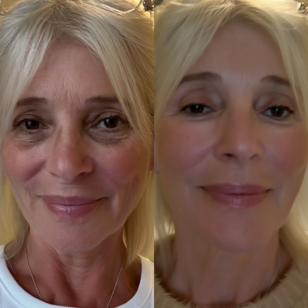 Lauren B. before and after