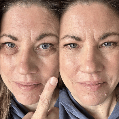 Before and after treatment