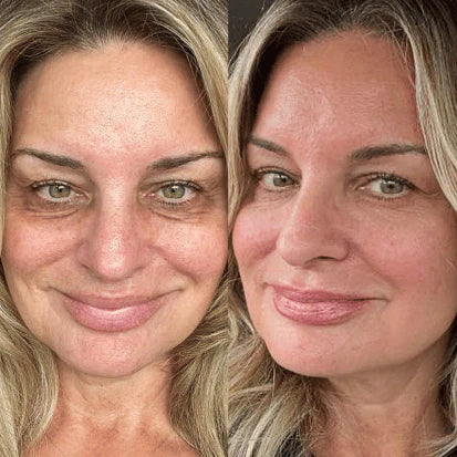 Side-by-side comparison of a woman's face with and without makeup