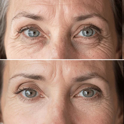 Before and after comparison of a woman's eyes with visible aging signs.
