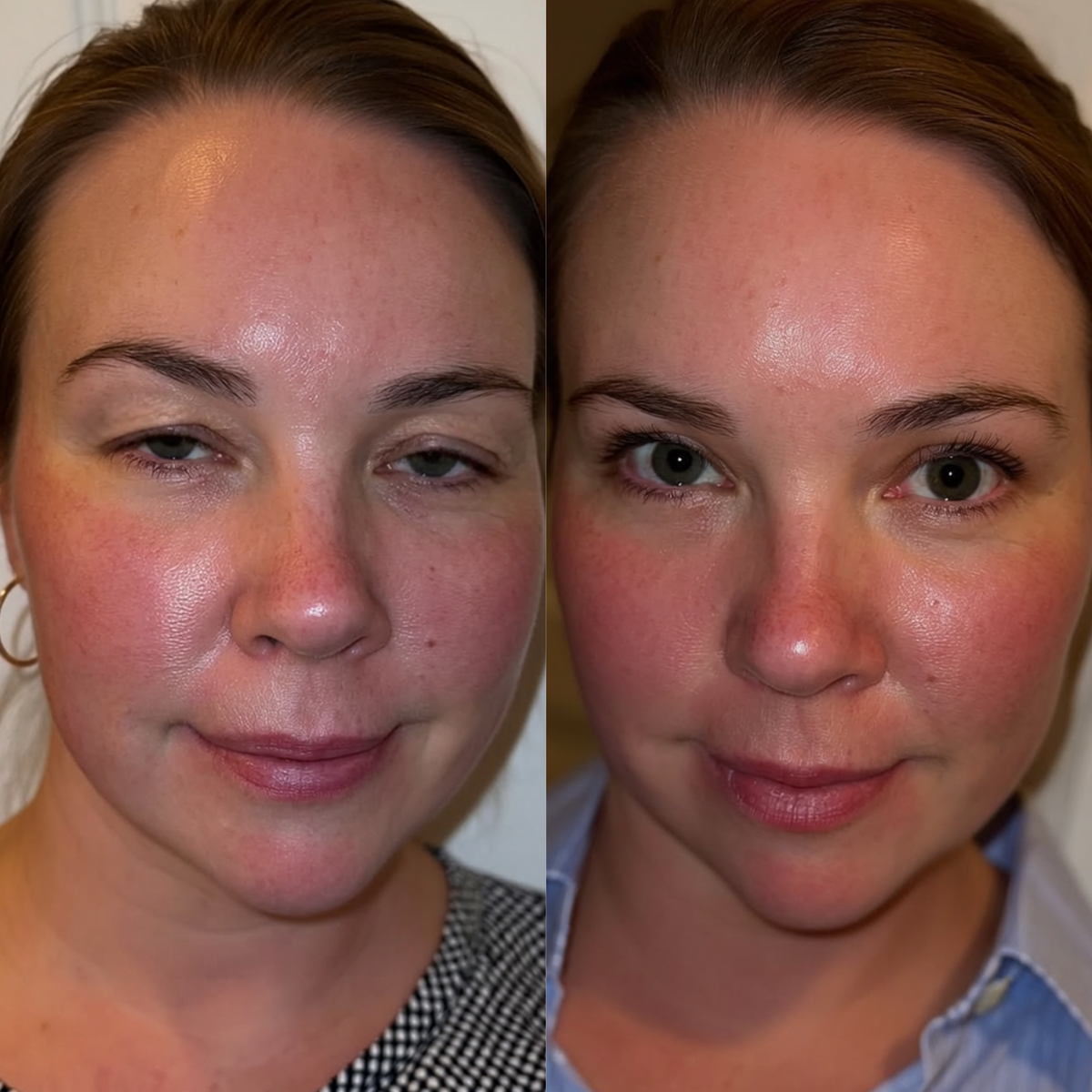 SLOT 7 — Before/AfterDanielle R., 38
