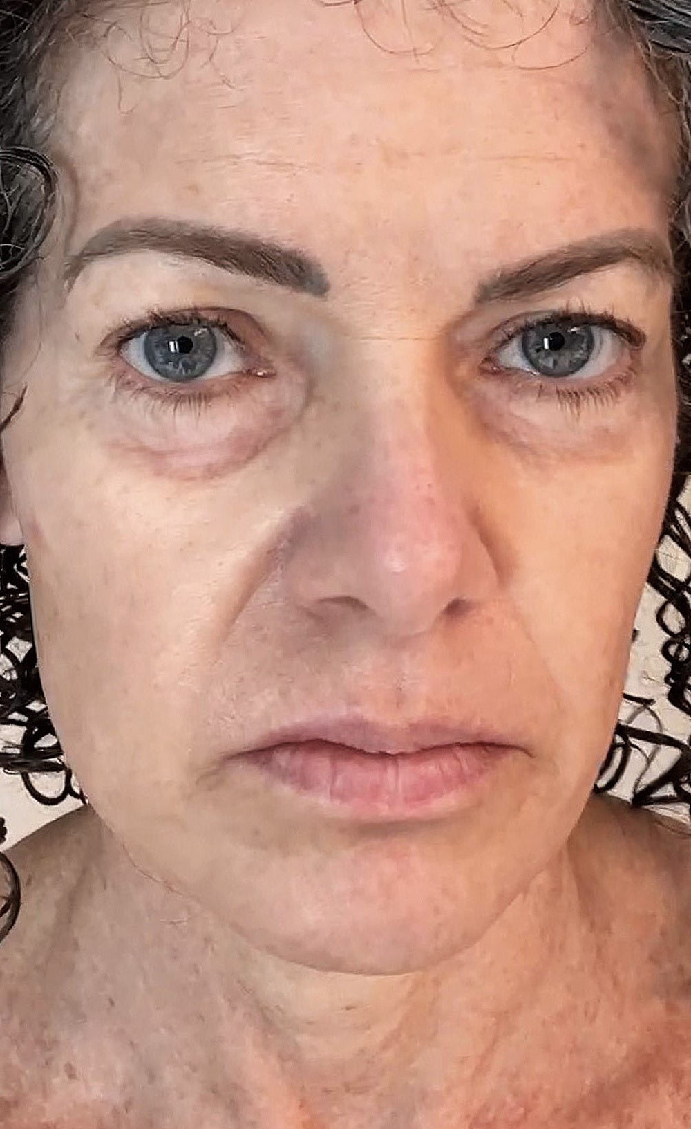 Close-up of a person's face with visible signs of aging.