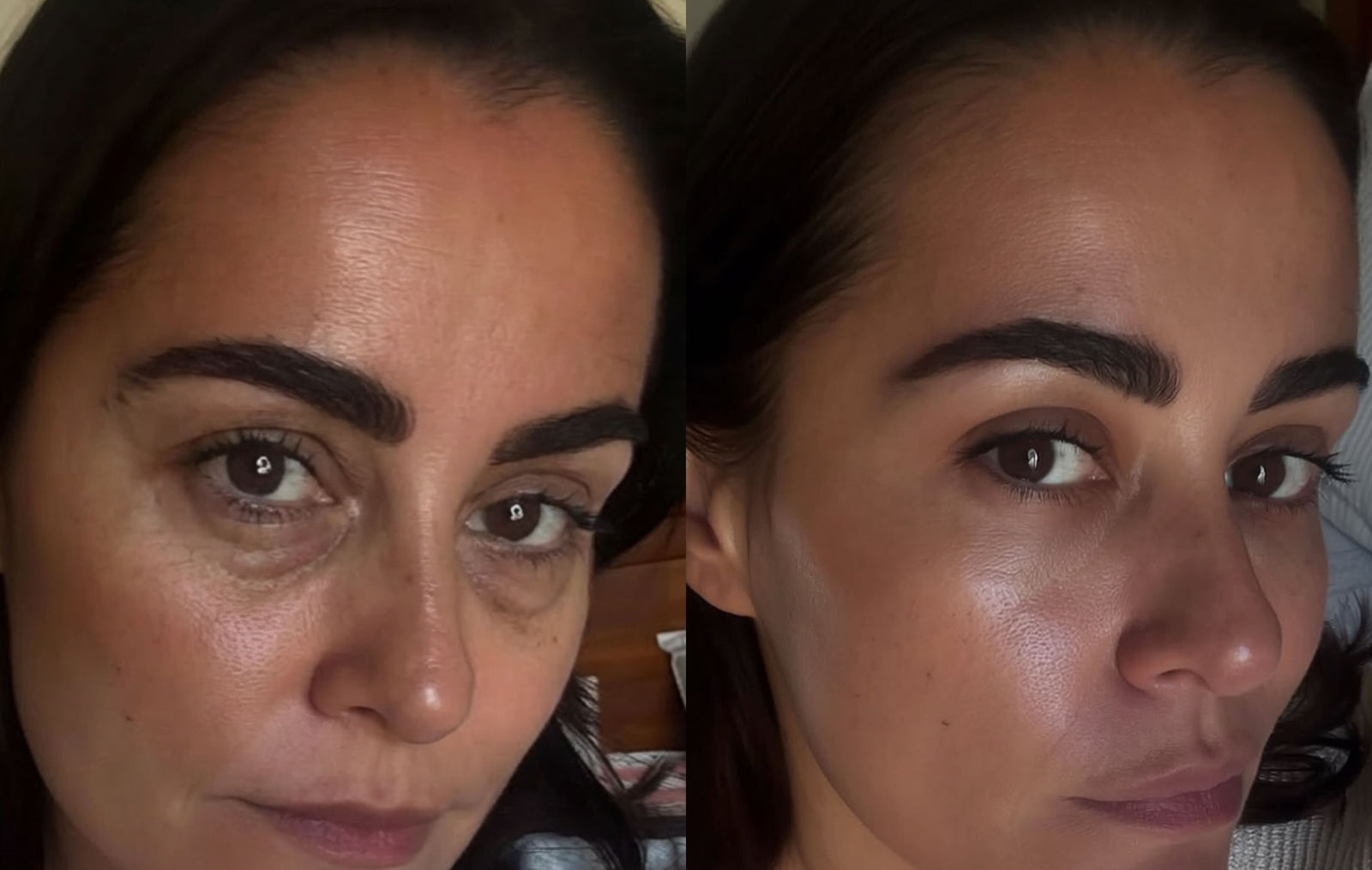 RevitalEyes