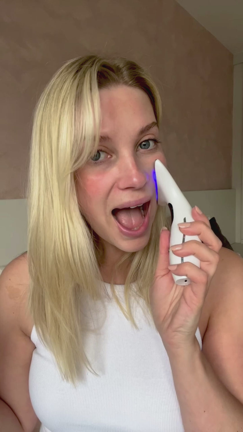 Woman showing visible results of LED face therapy device