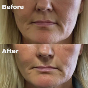 NLF_BeforeAfter