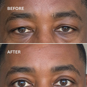 Men Funnel - Hooded Eyelids
