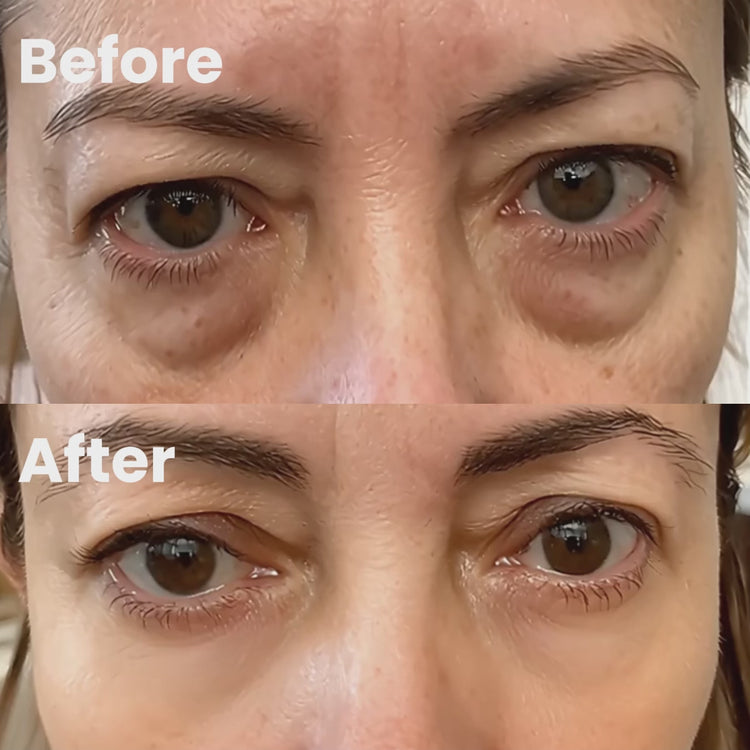 before-after