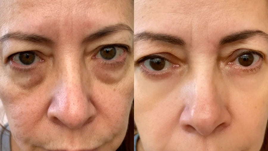 Customer testimonial result