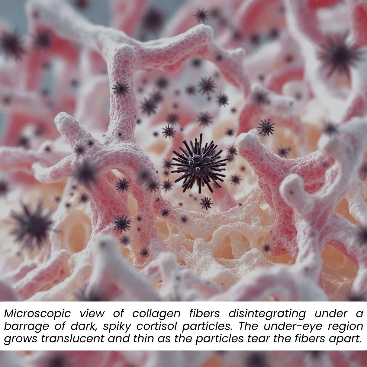 Microscopic view of collagen fibers disintegrating under cortisol particles